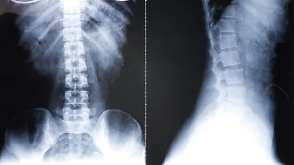 X-ray image — Stock Photo, Image