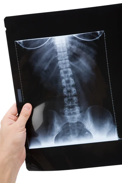 X-ray foto — Stockfoto