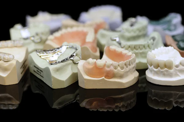Diş laboratuvar ürünleri — Stok fotoğraf