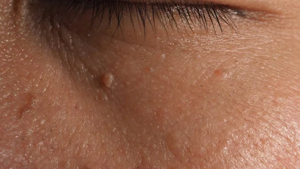 Een Pijl Het Gezicht Macro Schot Van Wrat Buurt Oog — Stockfoto