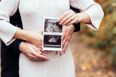 Hamilelik haberleri olan mutlu çift ultrason bebek taraması yapıyor. Hamile kadın ve kocası çocuk bekliyor. Hamilelik, hamilelik konsepti. Ebeveynler ellerinde röntgen tutarak hamile karnına dokunuyor. Yakın çekim
