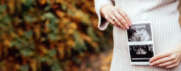 Hamilelik Haberleriyle Mutlu Hamile Kadın Ultrason Bebek Taraması Yapıyor Hamile — Stok fotoğraf