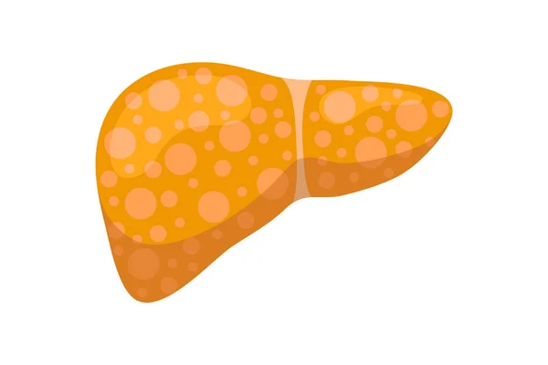 Sjuk ohälsosam lever med gulsot eller hepatit. Människa exokrin körtel organ förstörelse koncept. Vektor lever illustration — Stock vektor
