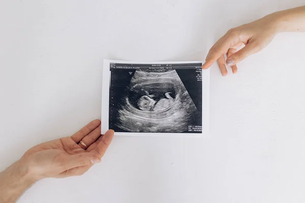 Couple Parents Holds Ultrasound Snapshot Future Baby Womb Concept Love — Stockfoto