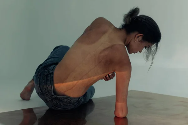 Beautiful young woman with amputee arm and scars from burn on her body poses topless. The concept of a fulfilling life of persons with disabilities. Back view.