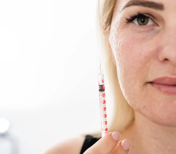 Verklig hud Biorevitalisering på vit bakgrund. Spår av biovitalisering injektioner på kvinnans ansikte. Biorevitalisering nålen markerar Skönhetsbehandling, riktiga papler efter hyaluroninjektion. — Stockfoto