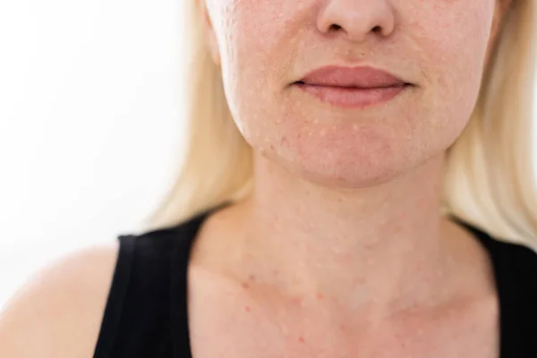 Az arc és a nyak életrevitalizációja. Az öregedés és a bőrpigmentáció jelei elleni küzdelem. — Stock Fotó