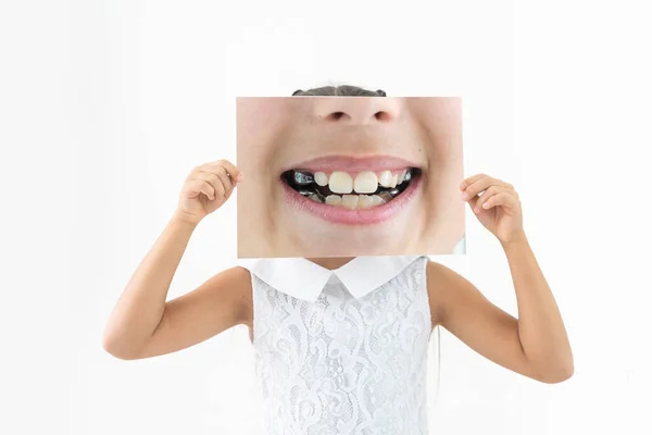 Kleines Mädchen zeigt ihre gesunden Zähne in der Zahnarztpraxis, lächelt und wartet auf eine Untersuchung. Frühe Prävention, Pädodontie und kein Angstkonzept. — Stockfoto