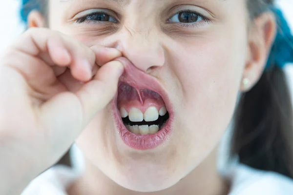 Bambina mostrando i denti sani allo studio dentistico, sorridente e in attesa di un controllo. Prevenzione precoce, pedodonzia e nessun concetto di paura. — Foto Stock