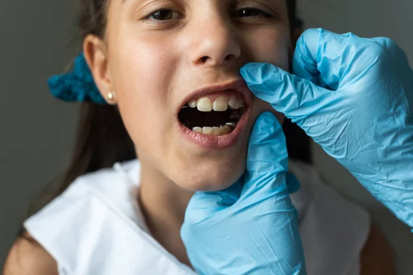 Vista recortada de la niñita revisando sus platos. Retrato de cerca de una adolescente sonriente con placas dentales contra un dentista sentado en la clínica. Chica con placas siendo examinado por el dentista — Foto de Stock