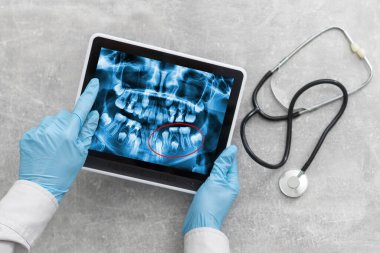 Sorunları tartışıyor. Çene ve diş gösteren profesyonel bir diş hekimi kadeh kırpılmış bir dijital tablet teknoloji gadget online sorunları Sağlık Tıp mesleğinin kullanarak onun hasta için röntgen kavramı yardım
