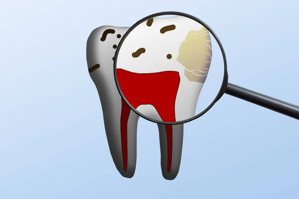 Rozmazlená Zkažená Ukázka Zubů Izolované Pozadí — Stock fotografie