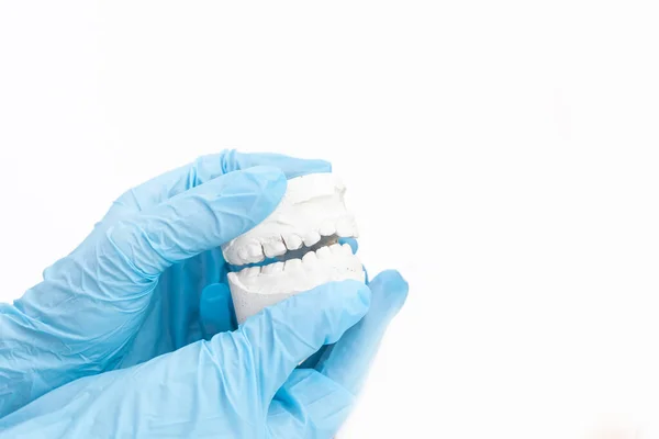 Ortodontis tangan, tercakup dalam sarung tangan medis biru memegang cetakan gigi rahang bawah. Giginya terlihat sedikit bengkok.. — Stok Foto