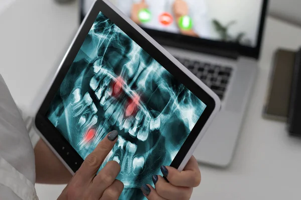 Discussing issues. Cropped shot of a professional dentist showing jaws and teeth x-rays to his patient using a digital tablet — Stock Photo, Image