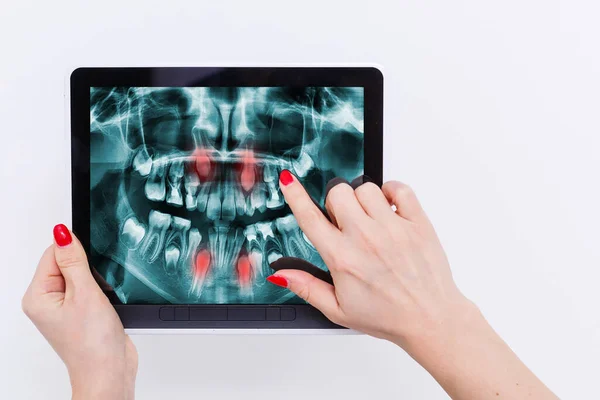 Tablet Dentist Office-Digital dengan pasien x-ray — Stok Foto