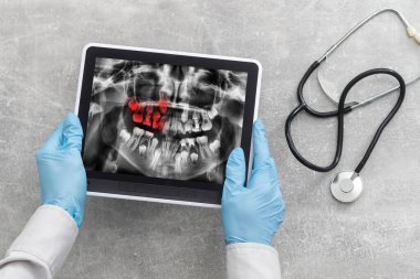 Diş hekimi Office dijital tablet bir hasta x-ışınları ile