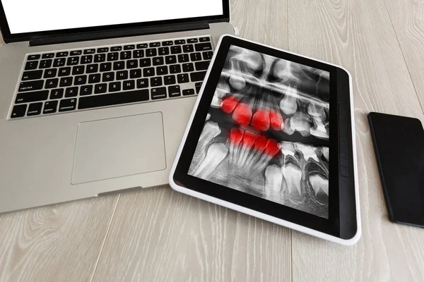 Dentist Office-Digital tablet with a patients x-rays — Stock Photo, Image