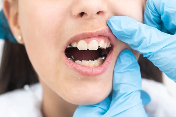 Dziewczyna wprowadzenie na medycznych Szelki do leczenia ortodontycznego na biały. — Zdjęcie stockowe