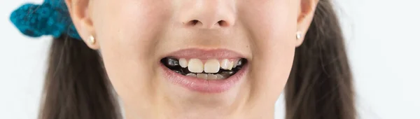 Menina com um prato em seus dentes — Fotografia de Stock