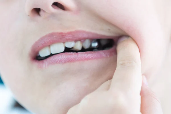 Potret gadis kecil yang lucu menunjukkan peralatan ortodontiknya pada latar belakang putih — Stok Foto