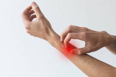 Deri iltihabı, egzama, alerji, sedef hastalığı. Kolunu kaşıyan bir adam, gri stüdyo arka planı. Adam kaşınıyor dirseğinde, kopyala boşluğu