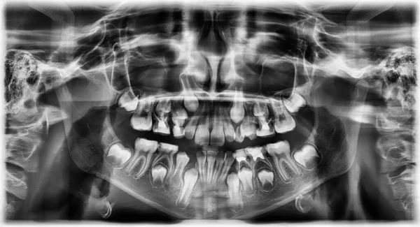 파노라마 엑스레이 치아 사진 — 스톡 사진