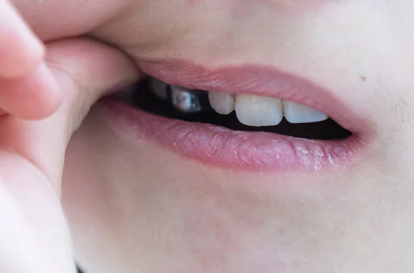 Portrait de petite fille mignonne montre son appareil orthodontique sur un fond blanc — Photo