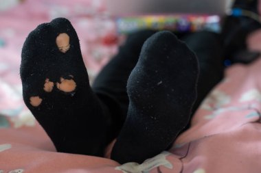 leaky socks on a mans leg, concept of poverty during the crisis