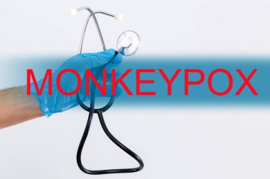 Steteskopla yazılmış MonkeyPOX deyimi. Tıbbi ve sağlık konsepti.