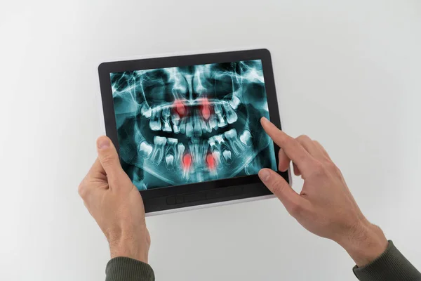 讨论问题。一名专业牙医用数码平板电脑向病人展示牙齿和牙齿X光的截图 — 图库照片