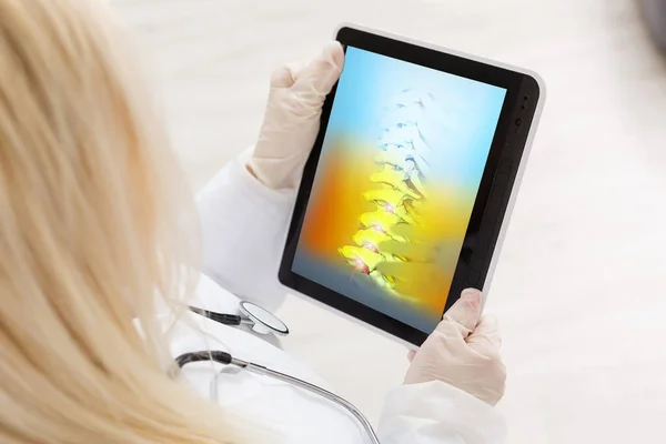 Doktor Sleduje Rentgen Kyčlí Páteře Proti Bolesti Zad Digitálních Tabletách — Stock fotografie
