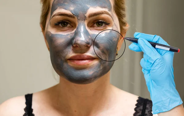 middle aged woman with correction marks preparing for plastic surgery.