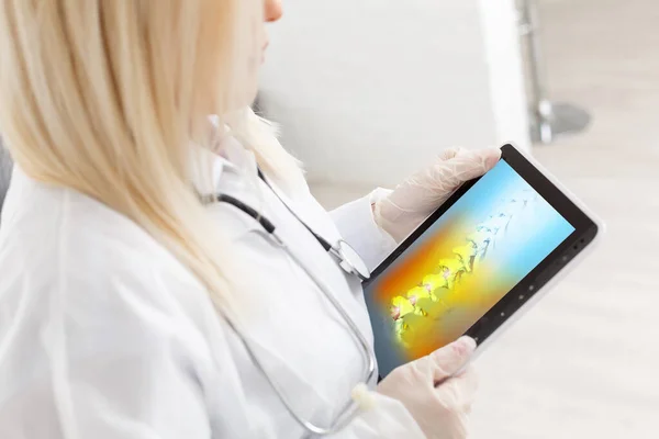 Γιατρός Κρατάει Μια Ψηφιακή Δισκίο Ακτινογραφία Της Σπονδυλικής Στήλης Σκελετό — Φωτογραφία Αρχείου