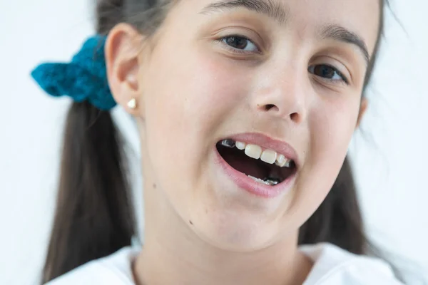 Portret Van Klein Schattig Meisje Toont Haar Orthodontische Apparaat Een — Stockfoto