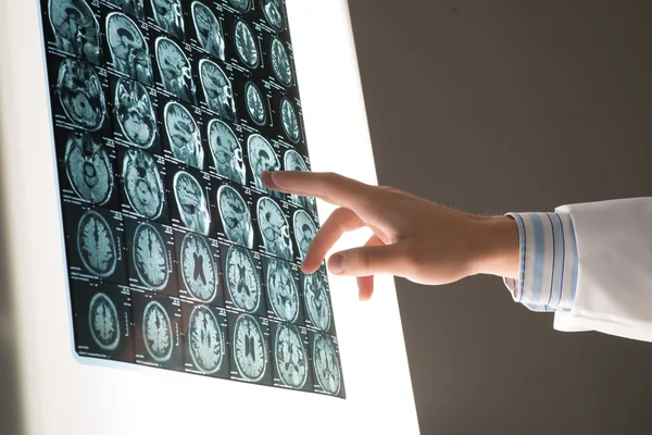 Доктор мужского изображения руки показывает рентген — стоковое фото