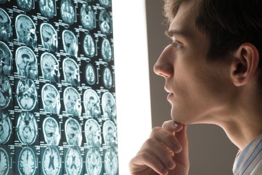 erkek Doktor Röntgen görüntü olarak arıyor