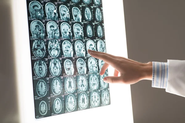 Imagen masculina de la mano del doctor muestra la radiografía —  Fotos de Stock