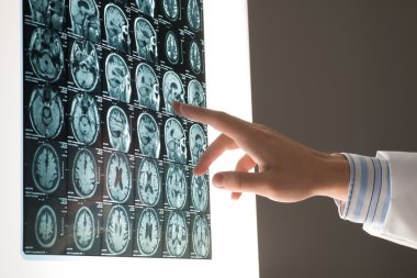 Doktor erkek el röntgen gösterilir