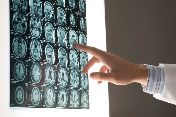 Imagen masculina de la mano del doctor muestra la radiografía —  Fotos de Stock