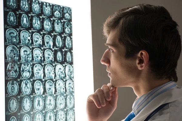 Doctor masculino mirando la imagen de rayos X — Foto de Stock