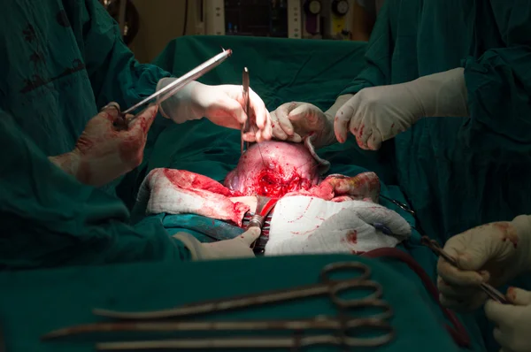 Cesarean afdeling — Stockfoto