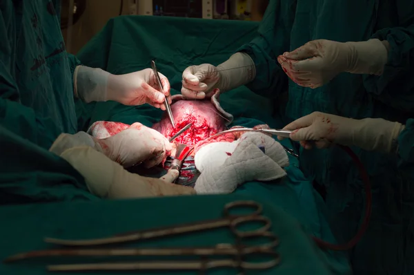 Cesarean section — Stock Photo, Image