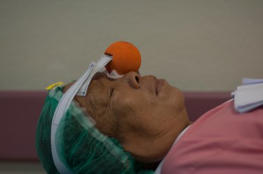 Katarakt sugery