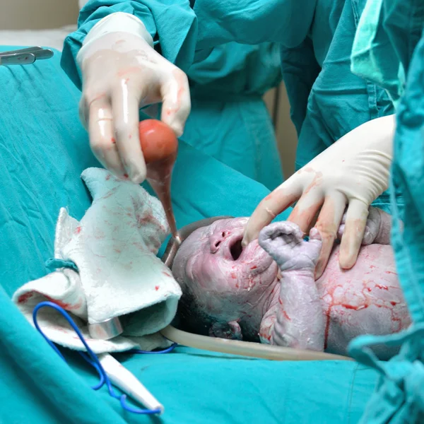 Cesarean sekcji — Zdjęcie stockowe