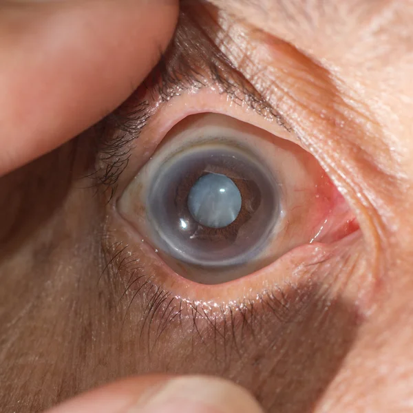 Eye examination. — Stock Photo, Image