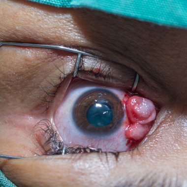 Eye examination. clipart