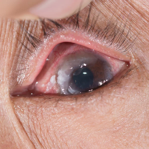 Eye examination. — Stock Photo, Image