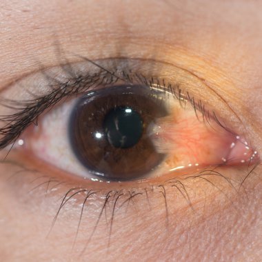eye exam clipart