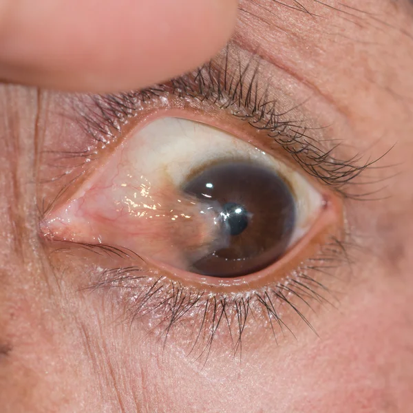 Eye exam — Stock Photo, Image