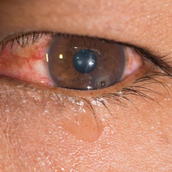 Eye exam — Stock Photo, Image